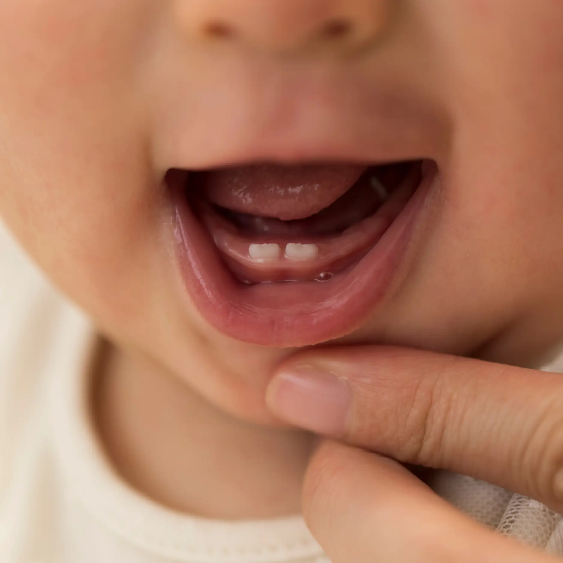 close up of infant's first two bottom teeth represents infant dental hygiene and infant tooth decay infant caries