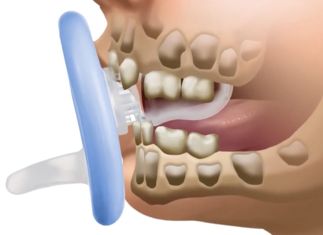 Animated anatomical diagram of how the Calm and Clean Pacifier Toothbrush works to clean teeth in a baby's mouth.